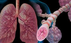 Respiratory problems are increasing due to construction and road dust