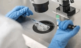 Sperm Tracking and Recovery (File Photo)